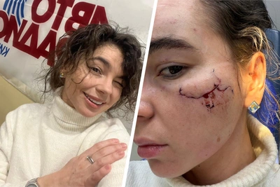 Королева красоты рассказала о состоянии после нападения в Казани