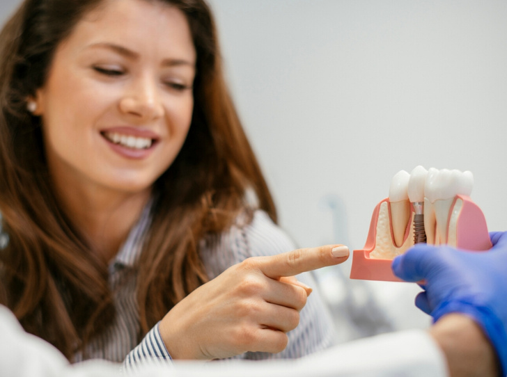 Мифы и правда об имплантации зубов