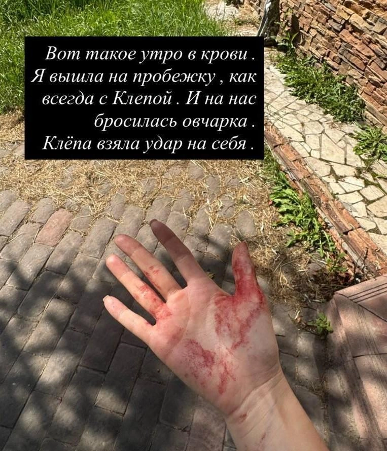Клёпа потеряла много крови | Источник: ilana7788 / Instagram.com (соцсеть запрещена на территории РФ)