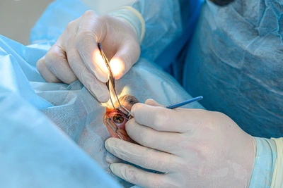 Врачи восстанавливают глаз двухлетнего ребёнка после ножевого ранения