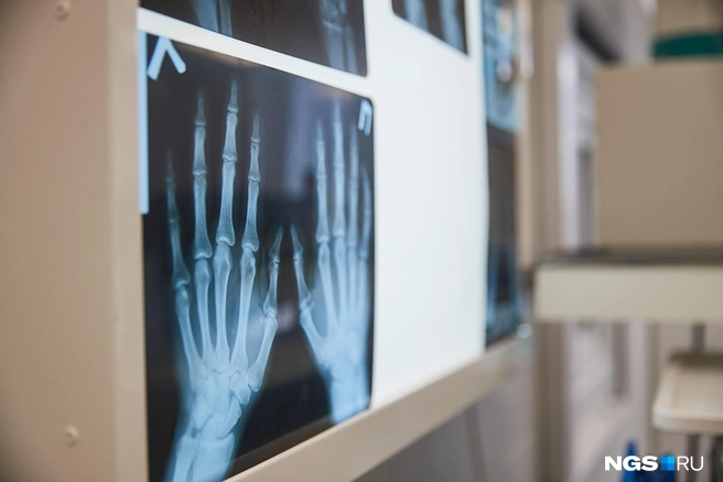 При падении мальчик выставил руки вперед и сломал их, а также повредил колено | Источник: Александр Ощепков / NGS.RU