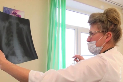 Череповецкая горбольница получит новый флюорограф