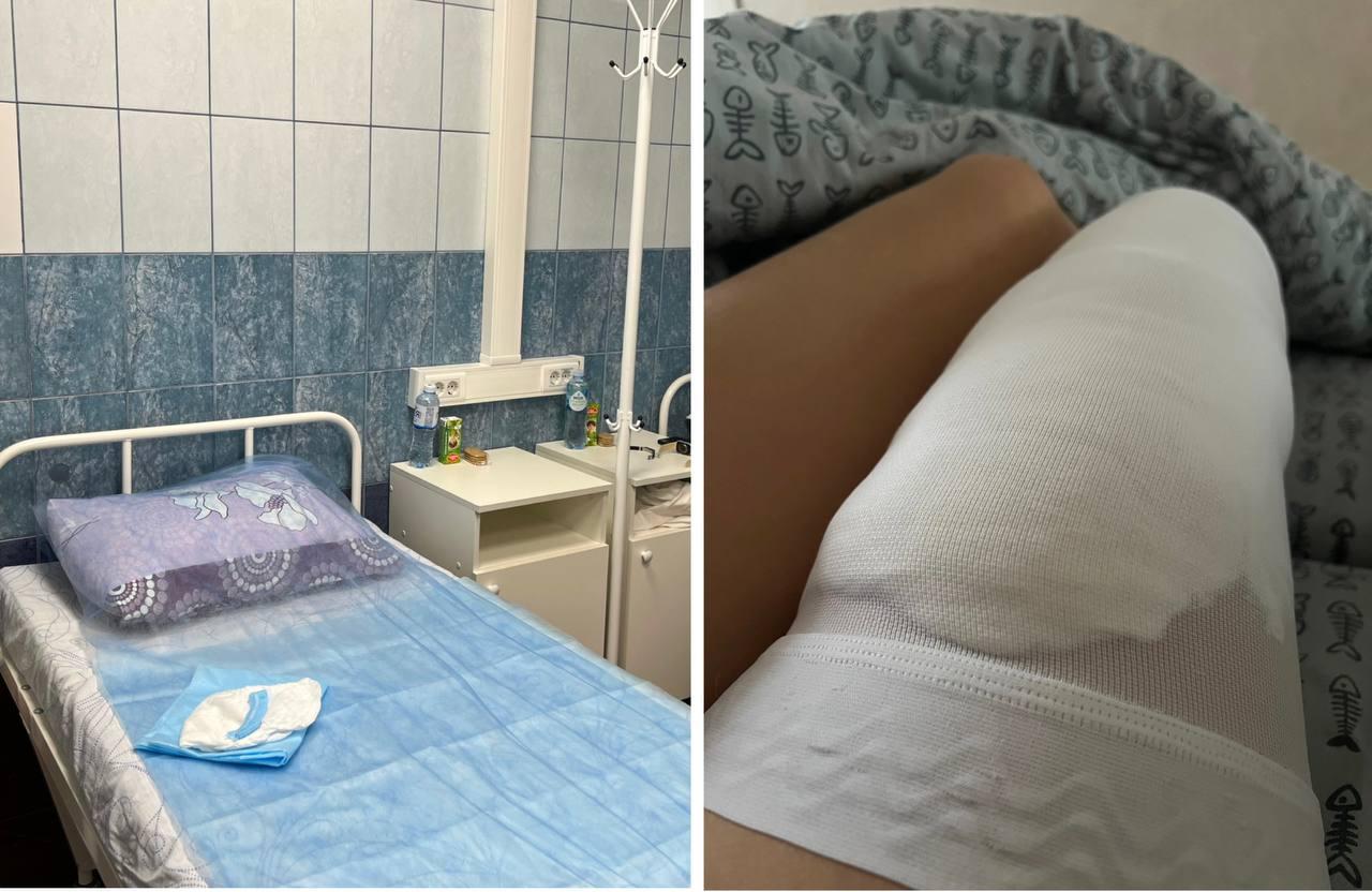 У вас варикоз? Как бесплатно сделать операцию по ОМС — личный опыт и пошаговая инструкция