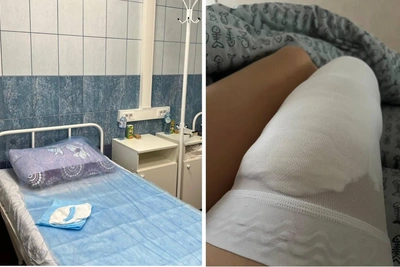 Лечение варикоза по ОМС в Мурманске: личный опыт