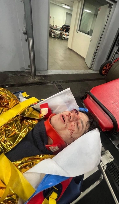 Подруга VACIO заявила, что рэпер попал в реанимацию, упав с крыши | Источник: Соцсети