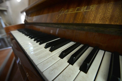 Пианистке в Самаре удлинили палец для мечты