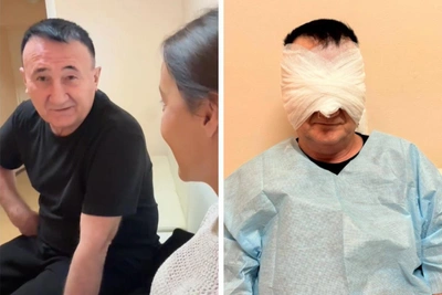 Tatar singer has facial surgery for wife 29 years younger