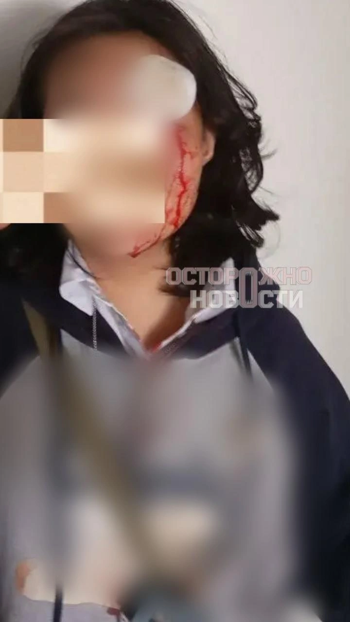 Две мамы избили школьницу в Москве из-за ее национальности | Источник: Осторожно, новости / T.me
