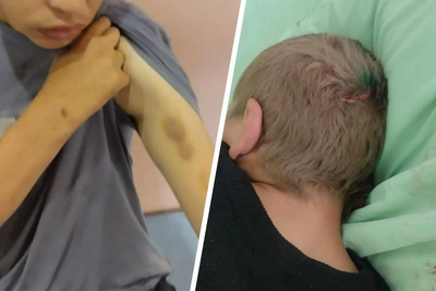 Residents Chained and Beaten? Footage Emerges from Prokopyevsk Boarding Home