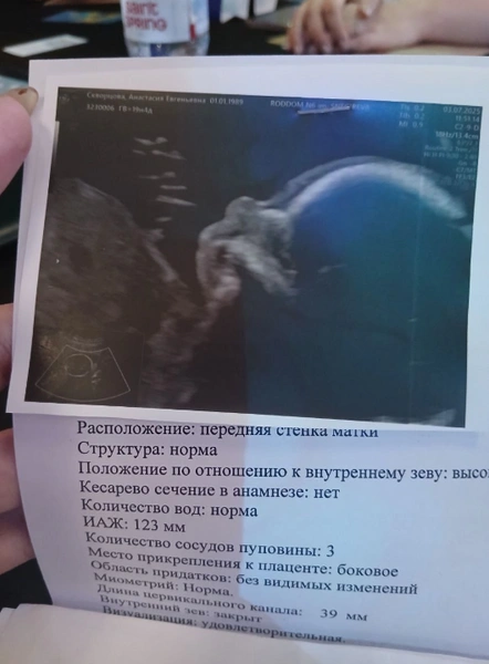 У Скворцовой родился здоровый ребенок