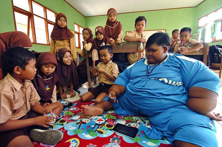 Арья Пермана, самый толстый мальчик в мире