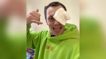 Корней Тарасов получил травму после тусовки