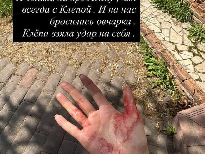 Клёпа потеряла много крови | Источник: ilana7788 / Instagram.com (соцсеть запрещена на территории РФ)