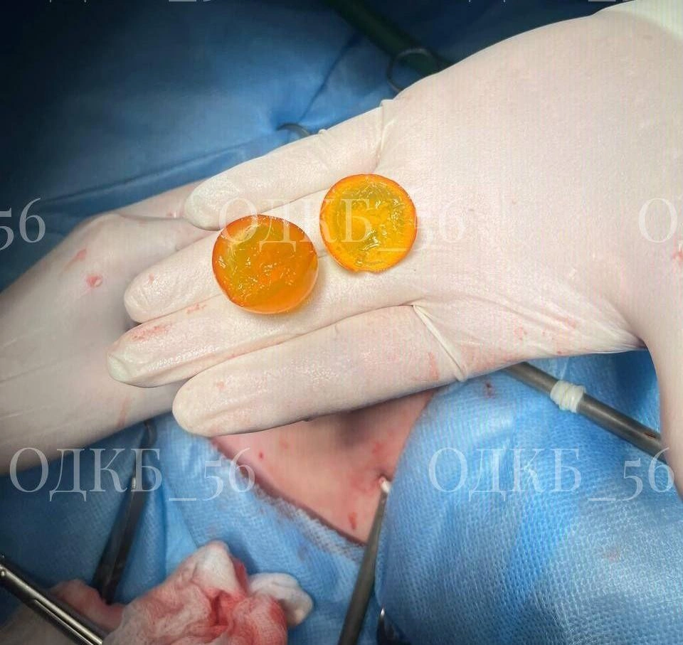 Источник: ОДКБ 56 (Юлия Шарифуллина)