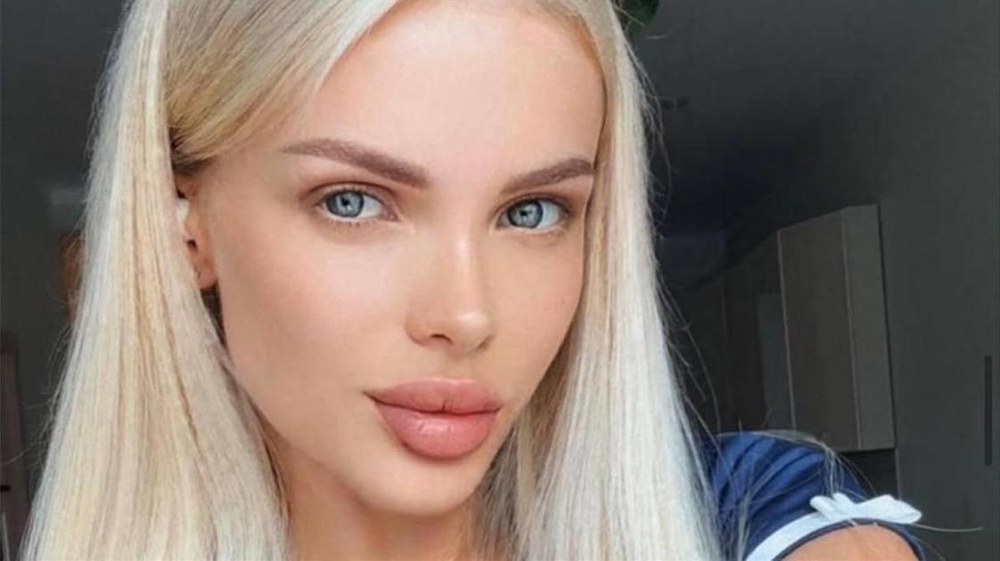 Зверски избитая модель назвала имя обидчика — он в бегах