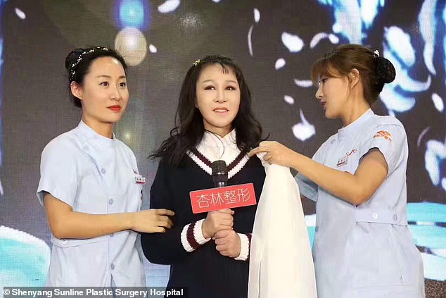 Китайская девочка из-за редкой болезни в 15 лет выглядела как старушка, но пластическая операция все исправила (фото)