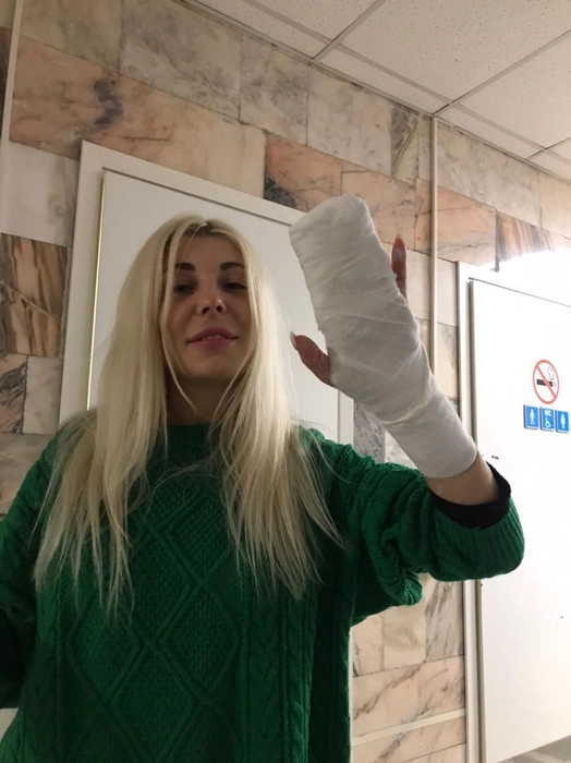 Надежда утверждает, что перелом пальца в феврале прошлого года — дело рук Максима | Источник: Надежда Малеева