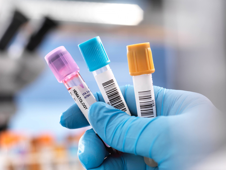 Анализ крови позволит выявить 50 видов рака