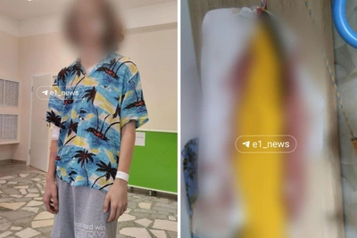Под Екатеринбургом подростка ранили ножом: нападавший задержан