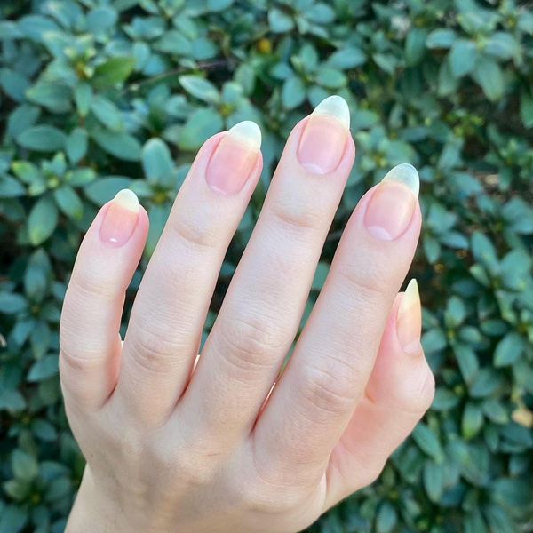 Почему желтеют ногти и как вернуть им здоровый цвет | theGirl