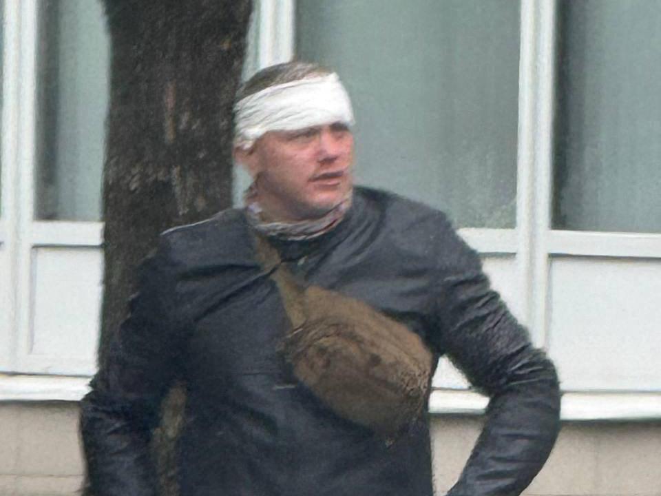 <p>Алексей Блиновский с перебинтованной головой после аварии</p>