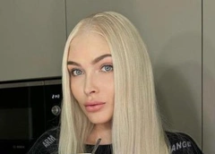 «Будет красота!»: Алена Шишкова сделала пластику