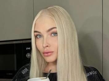 «Будет красота!»: Алена Шишкова сделала пластику