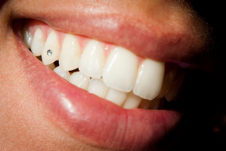 Опасные процедуры для зубов