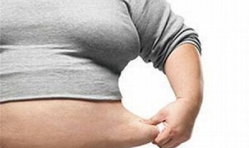 Ожирением в России страдают в основном женщины и малоимущие