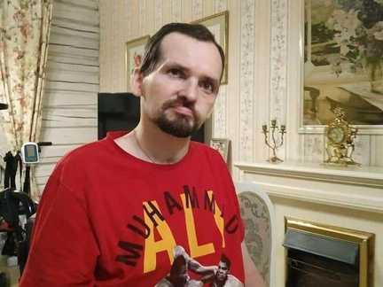 Алексей Янин скончался в реанимации после 20 дней в коме