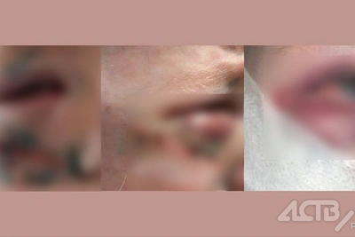 Сбил ребенка на самокате и скрылся: поиск в Южно-Сахалинске