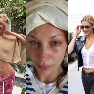 Как в США спекулируют на «хронической» болезни Лайма и что на самом деле происходит с Беллой Хадид?