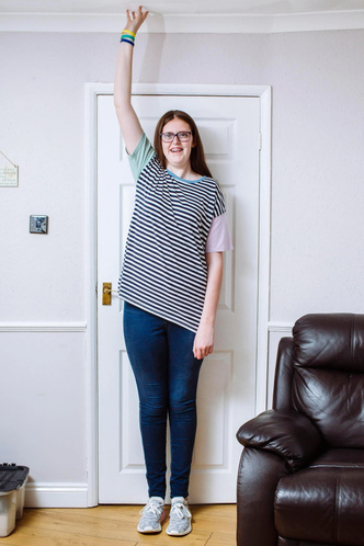 Как сейчас выглядит самая высокая девочка в мире, которая вошла в книгу рекордов — фото