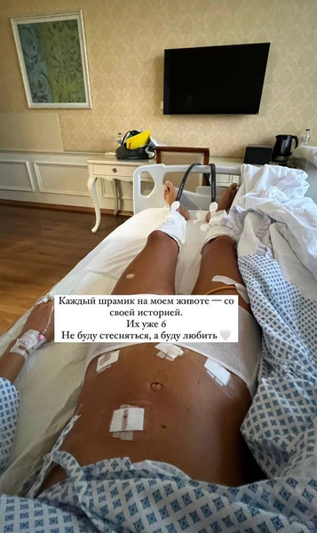 Блогер Саша Маркина чуть не погибла от рук невнимательного врача: подробности