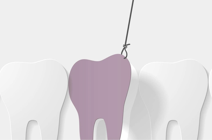 Как вырвать коренной зуб самостоятельно