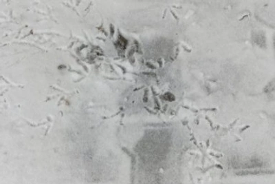 Артист-неудачник, рост цен, спасение черепашек и шашлыки