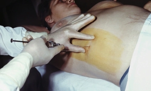 Лечить гепатиты В и С в Петербурге можно бесплатно или за 50 % стоимости курса терапии