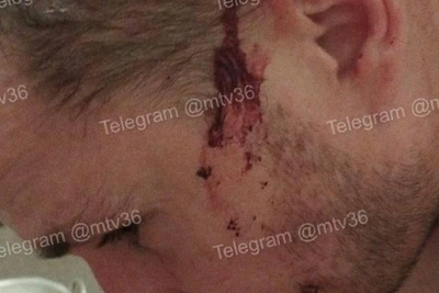 Школьники напали на мужчину из-за смеха