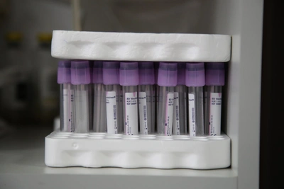 Рязанка обнаружила рак на ранней стадии после перерыва в осмотрах