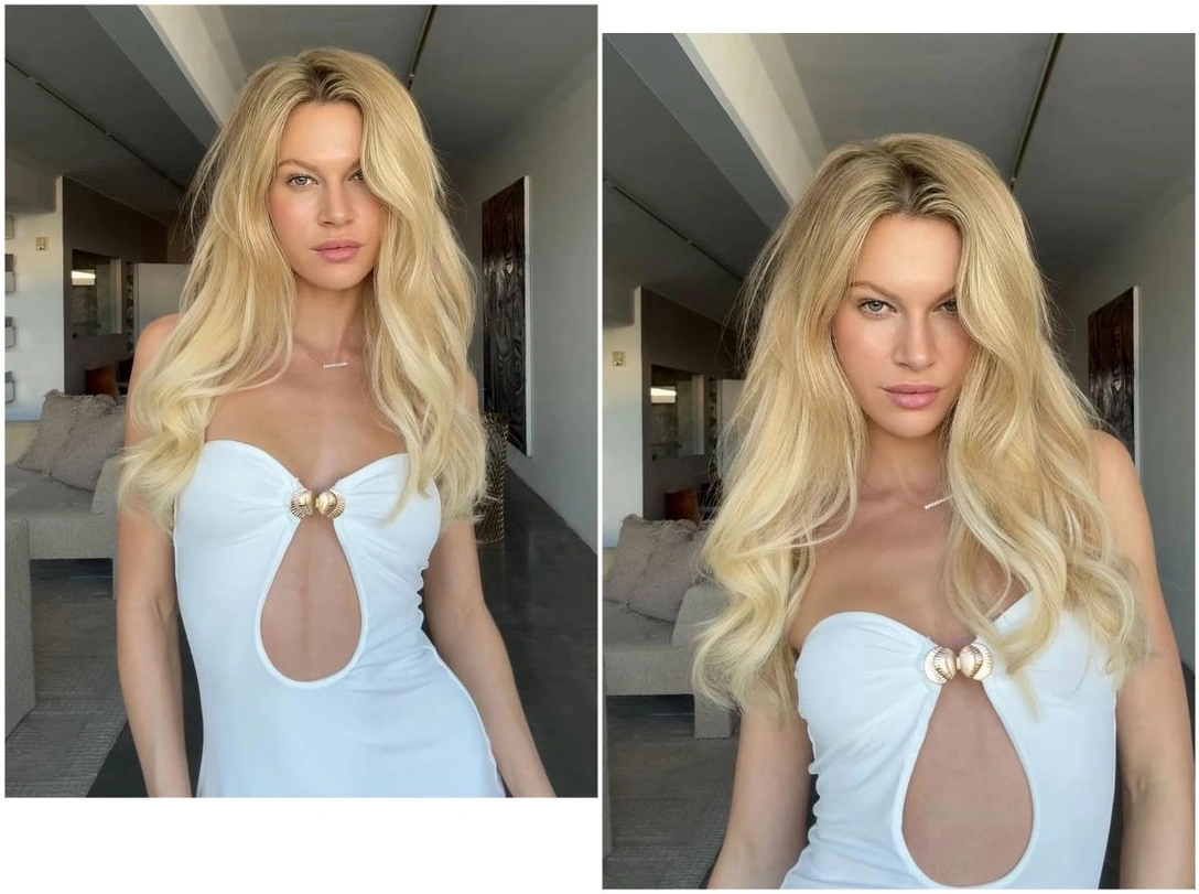 Как разбудить «спящие» луковицы волос — рекомендации трихолога | marieclaire.ru