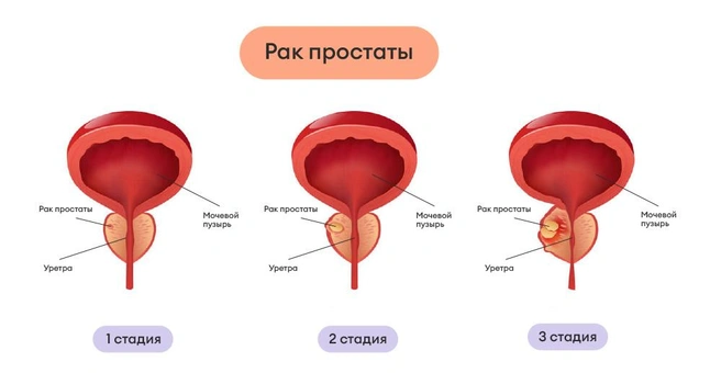Источник: www.panoramamed.ru