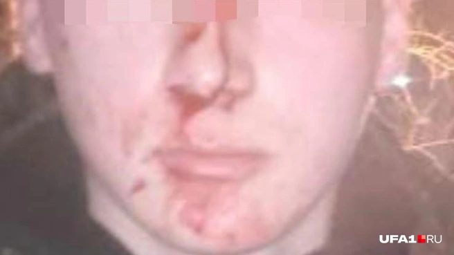 По мнению потерпевшей стороны, все могло кончиться куда хуже, если бы не вмешался командир | Источник: мать одного из пострадавших кадетов