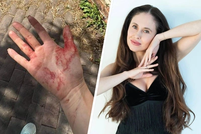 Овчарка напала на звезду «Уральских пельменей» и её собаку