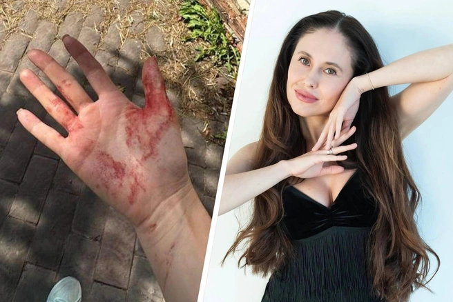 Звезда шоу «Уральские пельмени» рассказала, что на нее напала овчарка | Источник: ilana7788 / Instagram (деятельность запрещена в РФ)