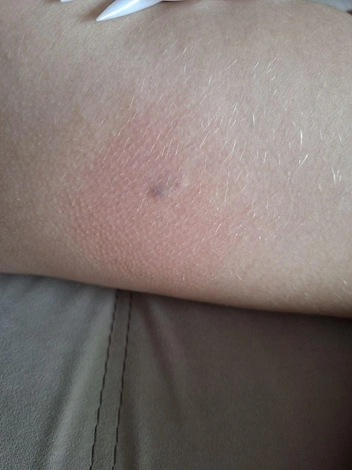 Кроме укусов… | Источник: vk.com/overhear_vrn