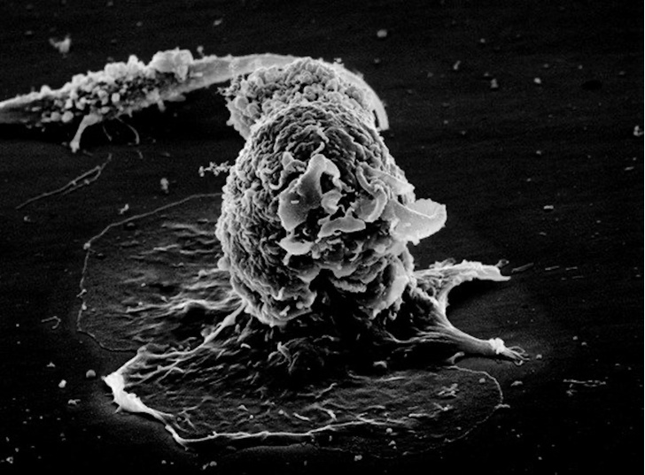 Учёные утверждают, что, кажется, нашли первопричину рака