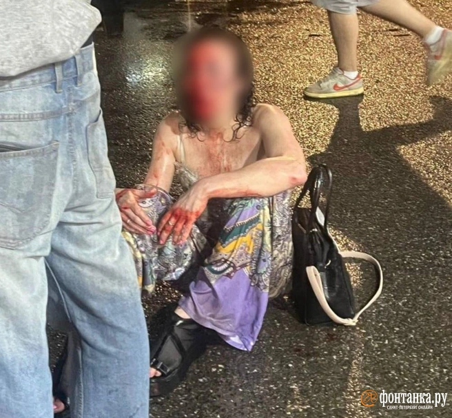 Одна в СИЗО, вторая на свободе после месяца в Дубае. А избитая в Петербурге подростками вдова участника СВО ходит по врачам | Источник: предоставлено адвокатом