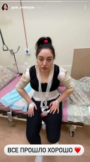 Вся в бинтах: фото и видео Гоар Аветисян после пластических операций