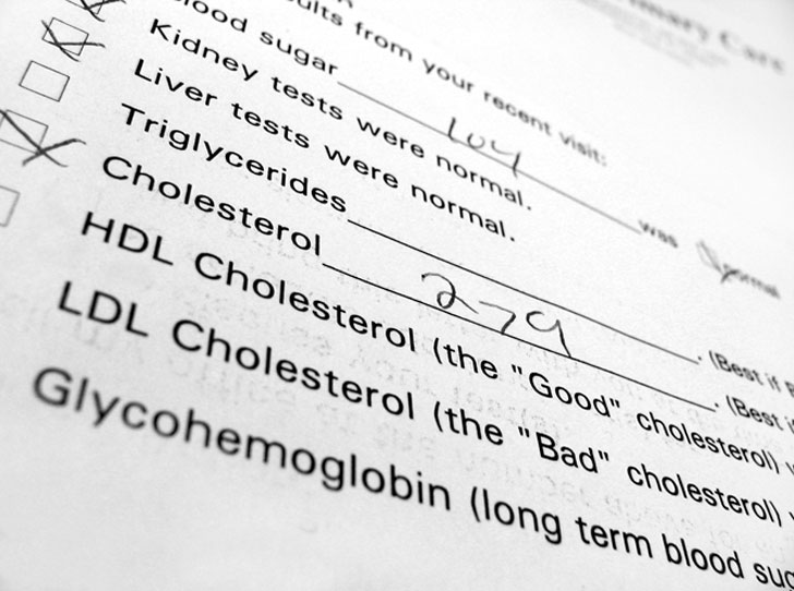 7 фактов о холестерине, которые вы не знали (или не принимали всерьез)
