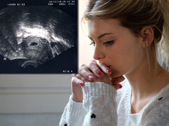 Из всех зол: что такое медикаментозный аборт и в чем его преимущества